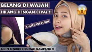 TIPS MENGHILANGKAN BELANG DI WAJAH amp MEMUTIHKAN KULIT DENGAN CEPAT MENGGUNAKAN BAHAN ALAMI [upl. by Fabrienne]