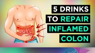 TOP 5 Drinks To HEAL Your INFLAMED COLON [upl. by Weihs578]