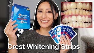 Crest Whitestrips RESULTS Test Review WOW 3D Classic Vivid teeth whitening kit [upl. by Dleifxam552]