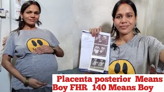 Placenta Posterior Means Boy FHR 140 Means Boy 🤰 [upl. by Llyrat]