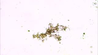 Bacterial bloom in freshwater aquarium under microscope [upl. by Orual]