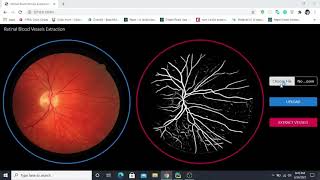 Retinal Blood Vessels Extraction from Retinal Fundus Images [upl. by Eckardt]