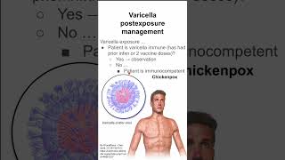 Varicella postexposure management [upl. by Babette]