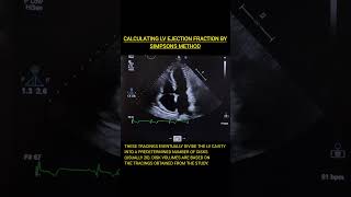 Simpsons Method  LVEF Calculation  echocardiography echo ultrasound sonography cardiology [upl. by Ecirpak]