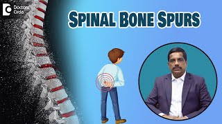 Spinal Bone Spurs  Symptoms amp Treatment Osteophytes  Dr Kodlady Surendra Shetty Doctors Circle [upl. by Kolivas]