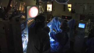 Holmium Laser for BPHMayo Clinic [upl. by Yssirhc]