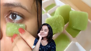 Permanent Treatment  7 Days Dark Circles Removal Challenge  Puffy Eyes Eye Bags Home Remedies [upl. by Sheply]