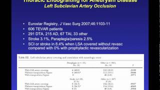 Endovascular Stent Grafting for ascending and aortic arch repair by John Ikonomidis MD Part 1mov [upl. by Elletnahc]