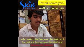 Pitted Keratolysis  Dermatologist  Dr Syed Bilal Shams skincenterpakistan [upl. by Asiaj]