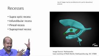 Exploring the Third Ventricle in Neuroanatomy  Brain Structures Simplified [upl. by Ayouqes]