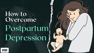 Postpartum Depression [upl. by Anifled]