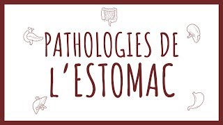 Sémiologie HGE  Pathologies Gastriques [upl. by Cicely753]