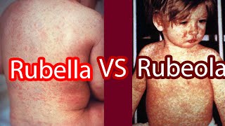 Rubella vs Rubeola Measles vs German Measles [upl. by Cardwell368]