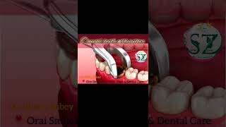 Tooth extraction decaid tooth tooth removal painlessdentistry dentalcare drrichadubey shorts [upl. by Affra]