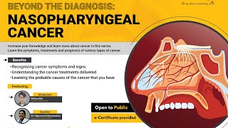 Beyond The Diagnosis Nasopharyngeal Cancer [upl. by Atiuqin]