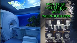 Mri c spine protocol with identification mri c spine Sequences [upl. by Ylyl352]