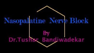 Nasopalatine Nerve Block made easy [upl. by Florine881]