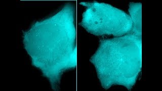 Firstever live tracking of HIV1 based lentiviral vectors in human cells [upl. by Kamillah]