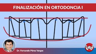 Finalizacion en ortodoncia parte I [upl. by Yruj]