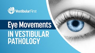 Eye Movements in Vestibular Pathology [upl. by Fillbert1]