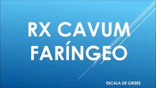 RADIOGRAFIA DE CAVUM FARINGEO [upl. by Norvan]