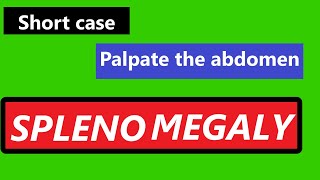 Medicine short case for MBBS  question amp answer for splenomegaly [upl. by Efar]