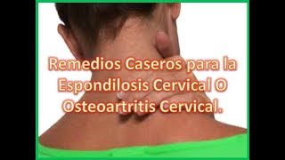 Remedios Caseros para la Espondilosis Cervical O Osteoartritis Cervical [upl. by Asiaj788]