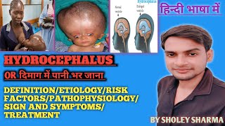 Hydrocephalus  Causes  Signs and Symptoms Diagnosis and Treatment  Bsc nursing  GNM ANM [upl. by Itsim]