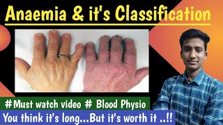 Anaemiaamp its Classification Blood PhysiologyLectures MBBS  in hindi Ashish [upl. by Schultz242]