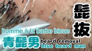 青髭男の髭抜きBluebeard mans beard removal Enlèvement de la barbe de lhomme à Barbe bleue [upl. by Ledda]