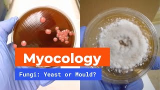 Microbiology Mycology  Yeast and Mould [upl. by Gurolinick]