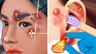 ASMR Piercing Cleaning Animation Removing Pus from Piercing Navel Stone [upl. by Anitsugua969]