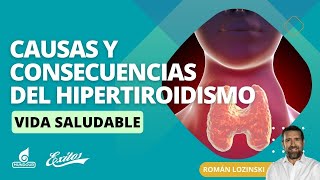 ¿Conoces las causas y consecuencias del hipertiroidismo [upl. by Amlet]