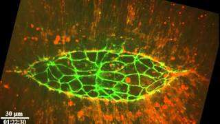 Dorsal Closure during Drosophila Development [upl. by Nailuj349]