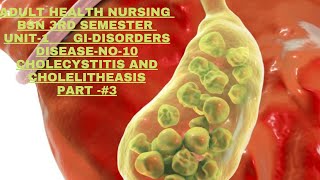 AdulHealthNursing BSN3rd semester Unitl GIDisorders Disease No10 Cholecystitis and cholelithiasis [upl. by Lladnar]