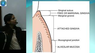 Periodontics 1 Normal Periodontium 1 Gingiva [upl. by Ahsito566]