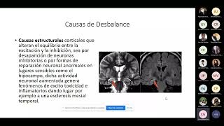 3 EPILEPSIAS  DR ESCALANTE NEUROLOGÍA UNFV [upl. by Golding807]