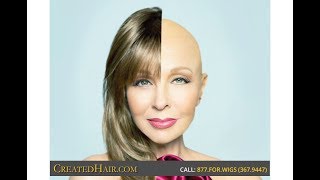 Wigs For Alopecia Los AngelesBest Wigs Wig Clip Tips [upl. by Iaka945]