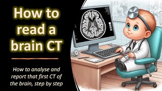 How to read a brain CT [upl. by Uel]