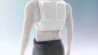 LifeVest Patient Education Video Chapter 3 Wearing the LifeVest [upl. by Itin]