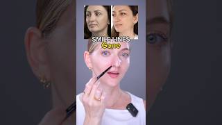 smile lines gone  Face Fitness  Facial Yoga  Face Massage  Face Work Out [upl. by Lynus]