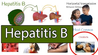 Hepatitis B symptoms treatment and prevention [upl. by Veljkov37]