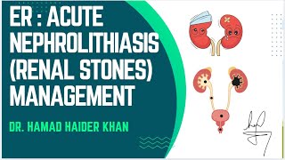 RENAL STONES  ER ACUTE MANAGEMENT NEPHROLITHIASIScasestudy emergency education [upl. by Ellehcin]