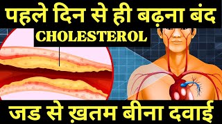 quotLower LDL Cholesterol Naturally Home Remedies amp Control Foods in Hindiquot [upl. by Darreg]