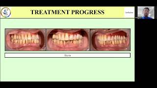 Geriadent 2024 Paper Presentation [upl. by Arbmahs]