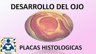 Embriologia Desarrollo de ojo Placas histologicas [upl. by Drobman]