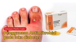 Penggunaan Antimikrobial pada luka diabetes [upl. by Giselle920]