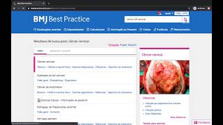 Como realizar uma busca no BMJ Best Practice [upl. by Harbard]