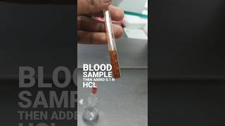 Haemoglobin estimation practical1st year MBBS mbbs gmc shorts [upl. by Ykroc]