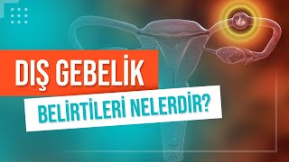 Dış Gebelik Nedir Dış Gebelik Belirtileri Nelerdir Dış Gebelik Normal Gebeliğe Dönüşür Mü [upl. by Morrissey]